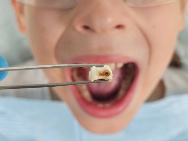 Best Emergency Dental Surgery in New Buffalo, MI